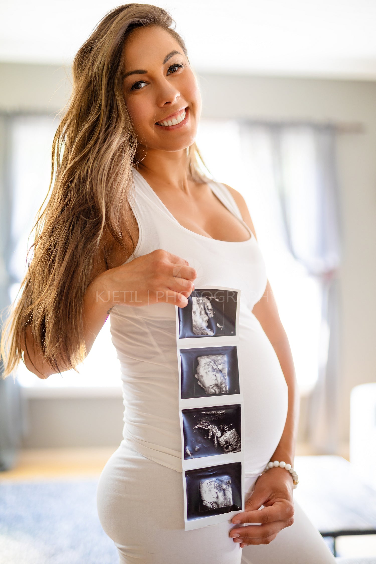 Cheerful pregnant woman holds ultrasound photo at her belly