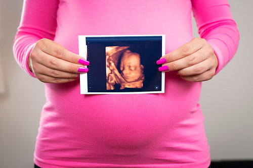 Pregnant woman holds ultrasound photo at the belly