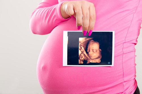 Pregnant woman holds ultrasound photo on the belly